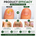 Nail Plus Serum for Nails Repair & Growth