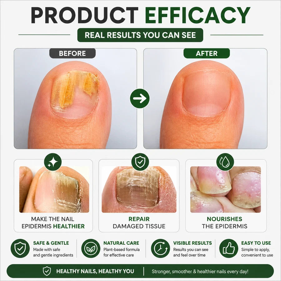 Nail Plus Serum for Nails Repair & Growth